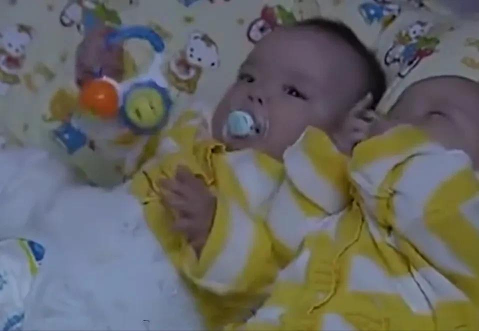 女子生下连体双胞胎后续,女子产下同母异父双胞胎完整版