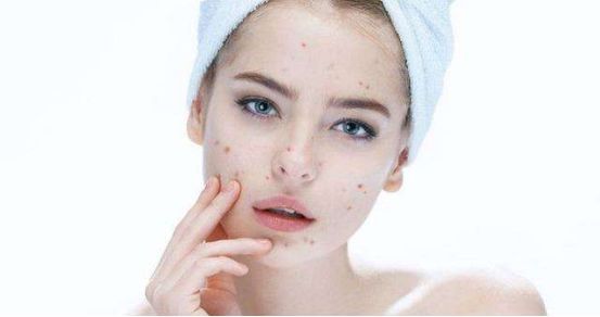 控油和抗皱,控油和抗敏一体