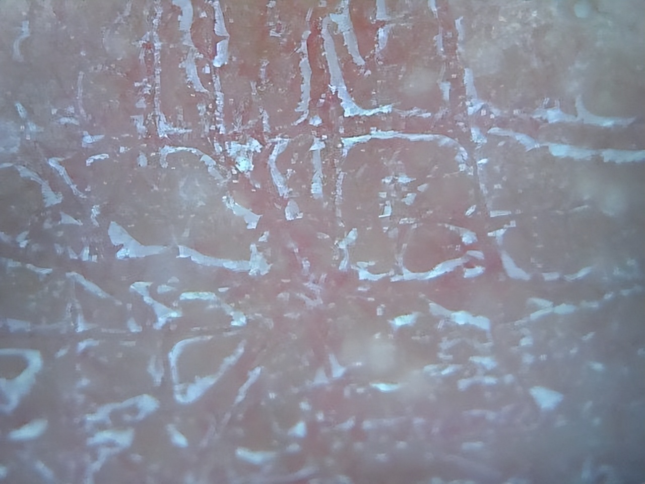 洗完澡身上痒还起皮是怎么回事,洗完澡皮肤干燥起皮浑身痒