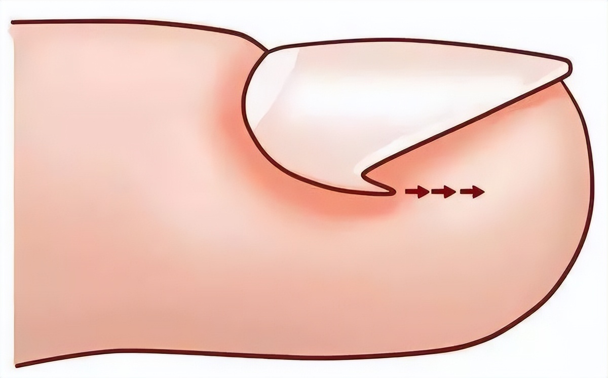 泳池的水有多脏,游泳怎么样可以防止下体进水感染