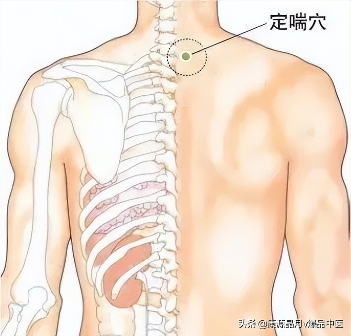 中医精华之人体特效穴,经外奇穴69个疑难杂症图解