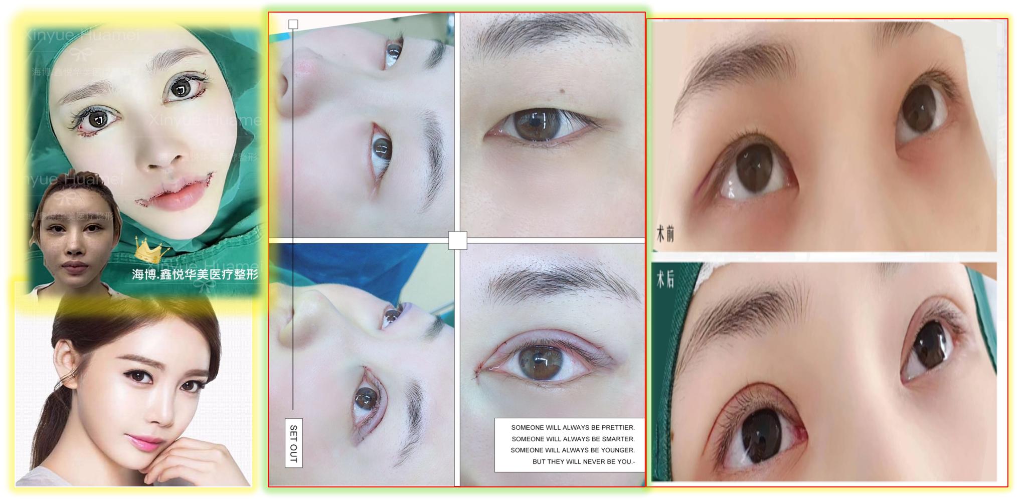 海博医美在哪里,海博医美集团