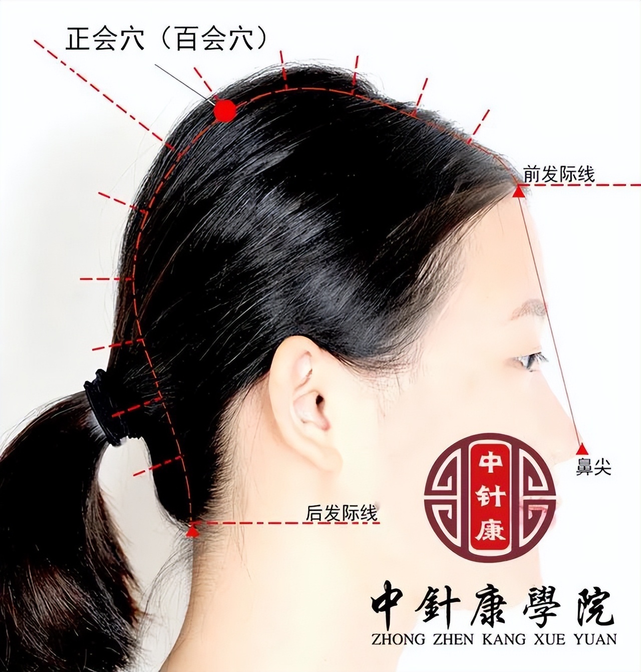 （二）董氏奇穴临床运用体应针法与灸法