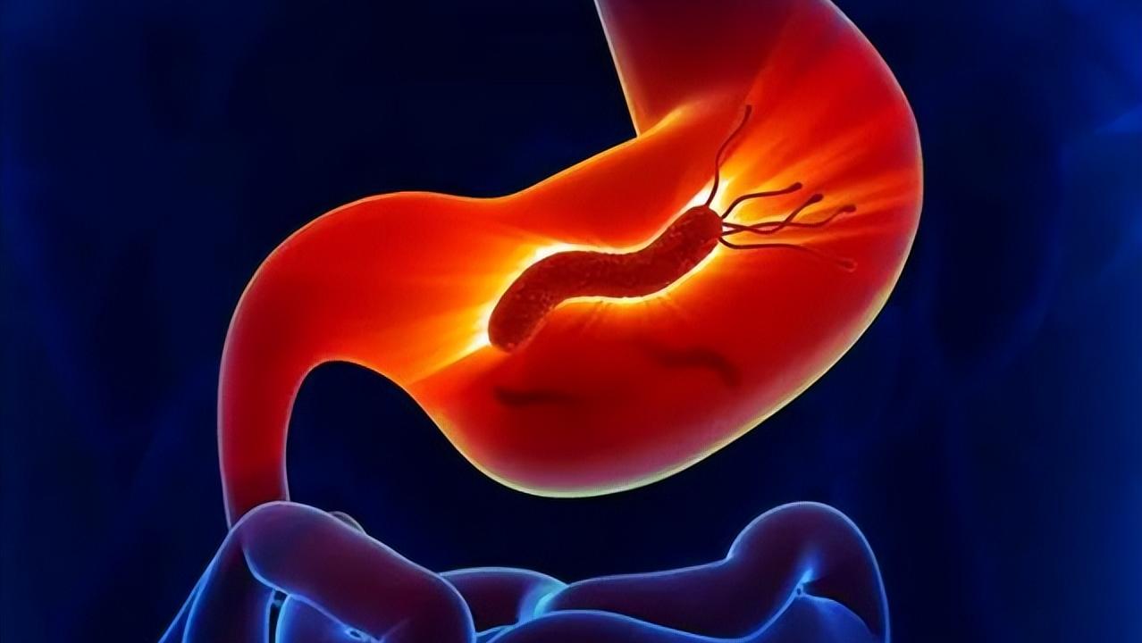 幽门螺杆菌感染阳性可以治好吗,幽门螺杆菌阳性是不是很严重