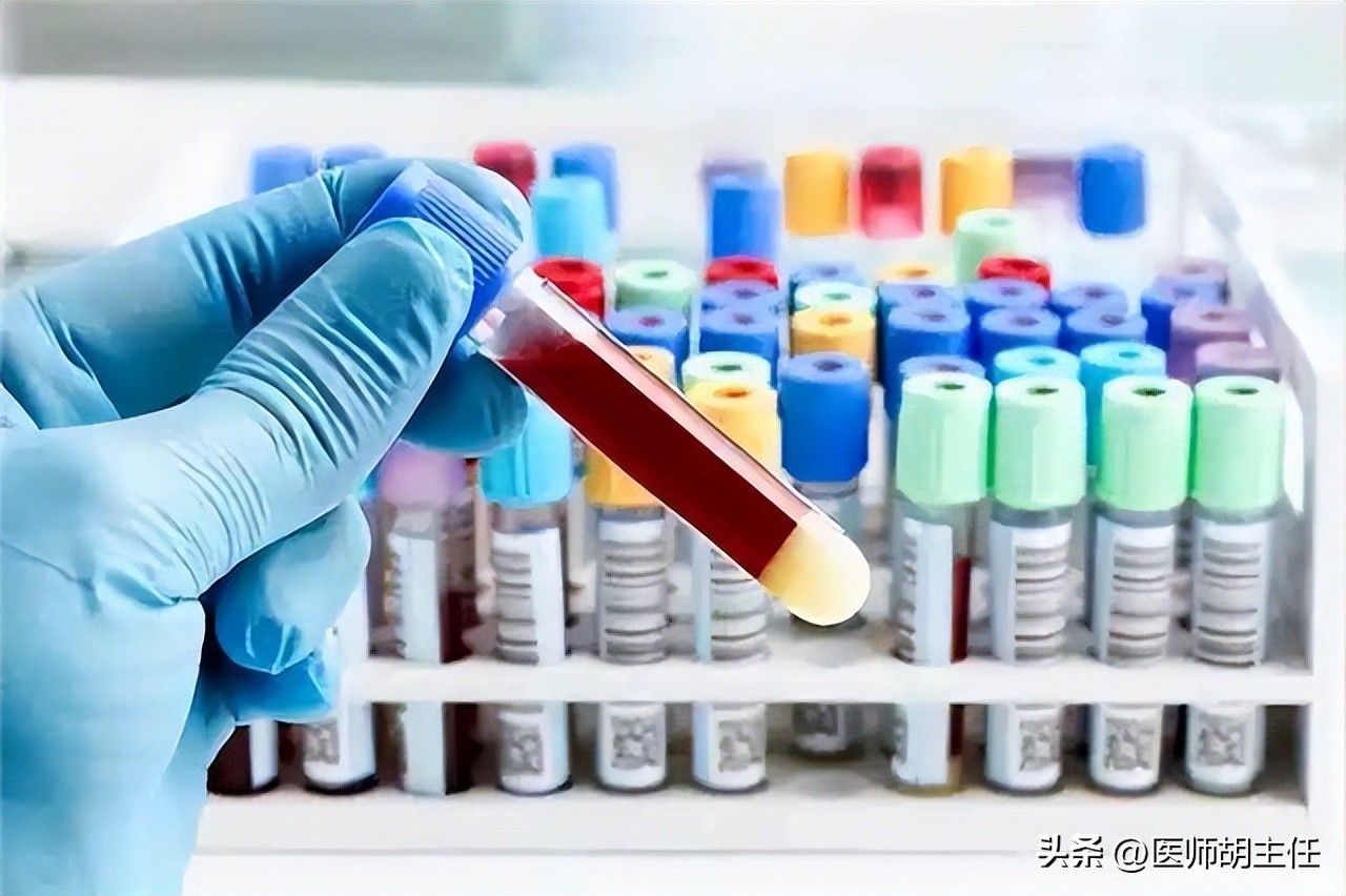 肝病胆红素偏高怎么才能降下来,体检胆红素偏高怎么快速降低