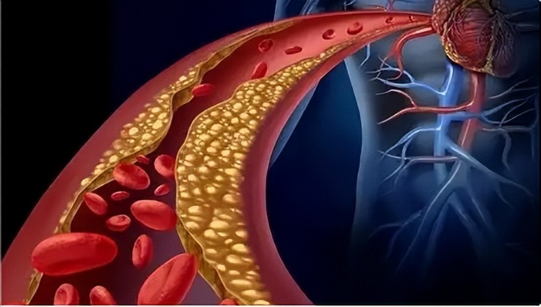 身体出现6个症状暗示猝死降临,身体出现这6种信号警惕猝死