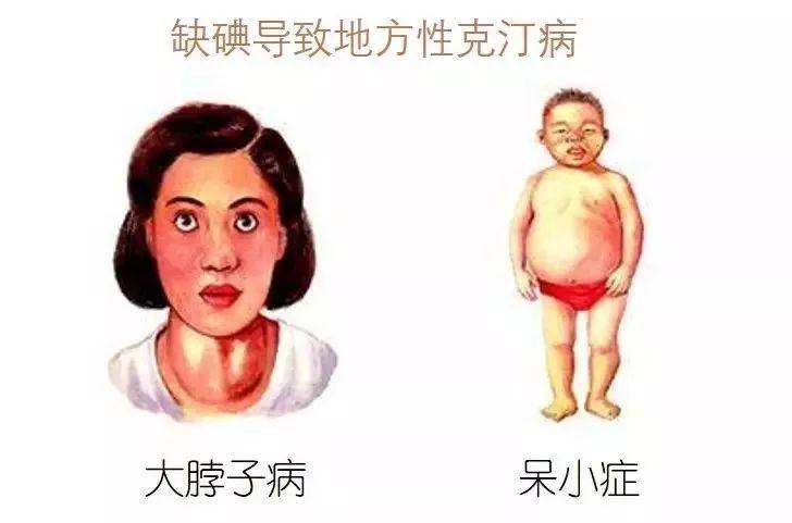 怎样补碘和锌,如何补碘盐