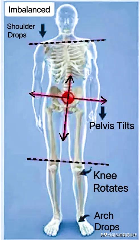 歪头斜脖子矫正方法,歪头歪脖怎么矫正
