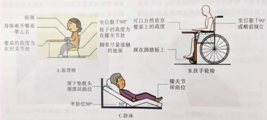 “难咽之痛”——吞咽障碍如何应对？