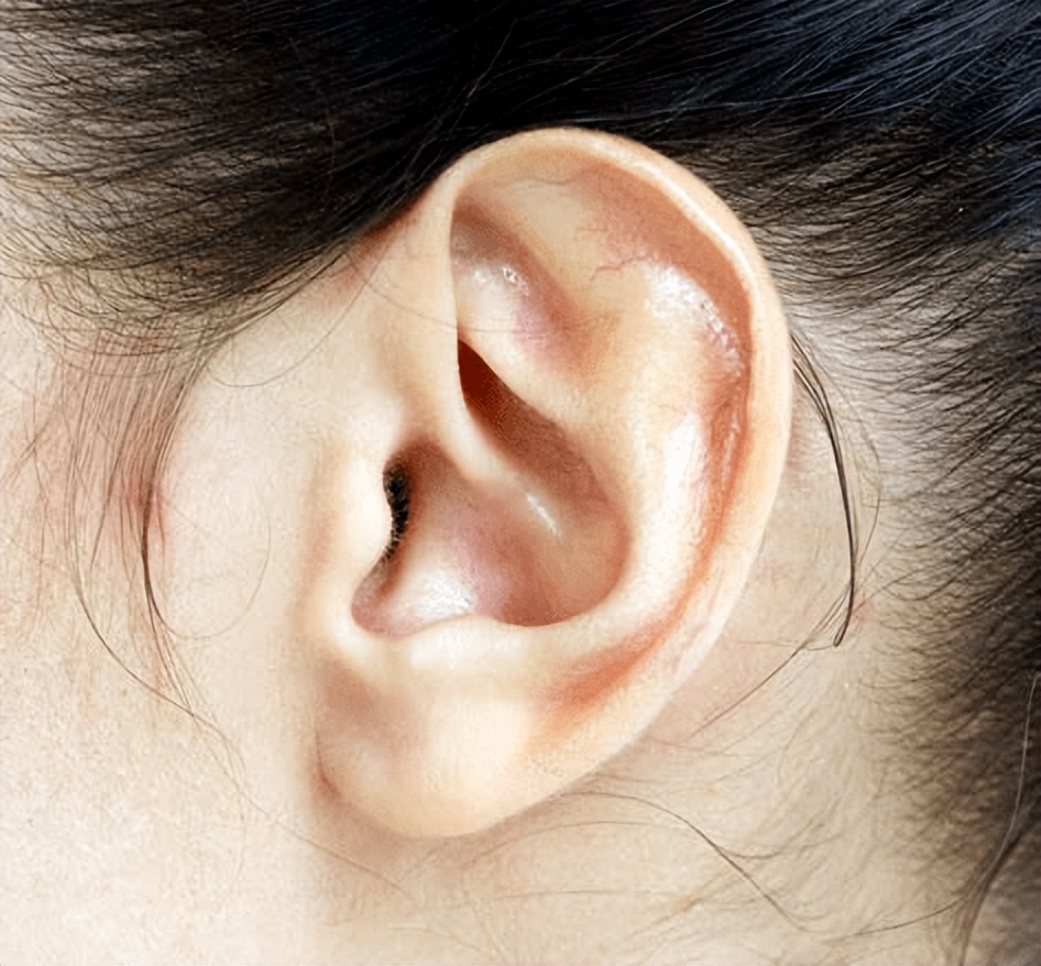 掏耳屎正确方法,自己掏耳屎正确方法