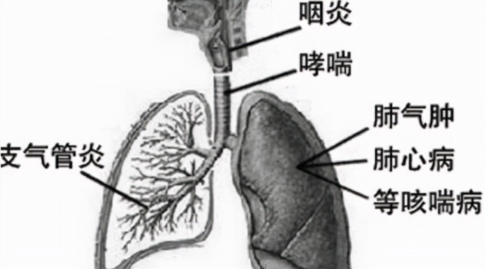 “甲硝唑”便宜又好用，能治什么病？在这5种病中占有一席之地