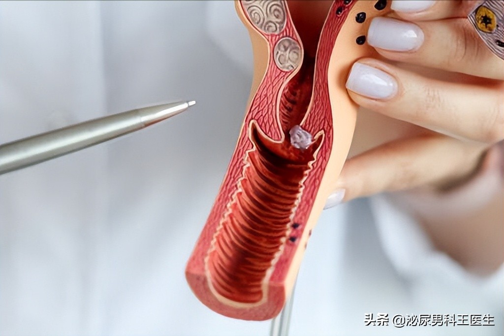 子宫切除以后对身体有什么影响,子宫切除后对身体有什么影响