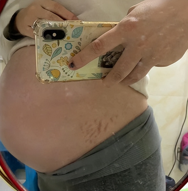 6款妊娠油推荐,妊娠油乳