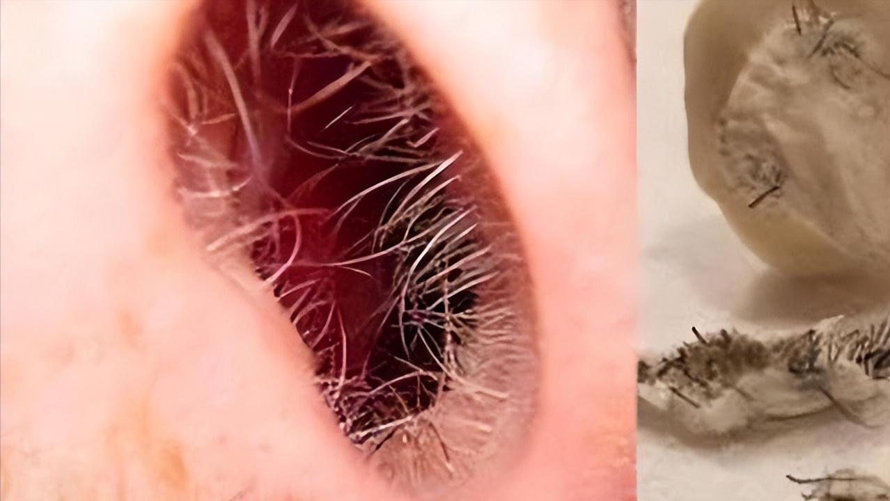 为什么男人的鼻毛总是窜出来,为什么男生的鼻毛总是往外长