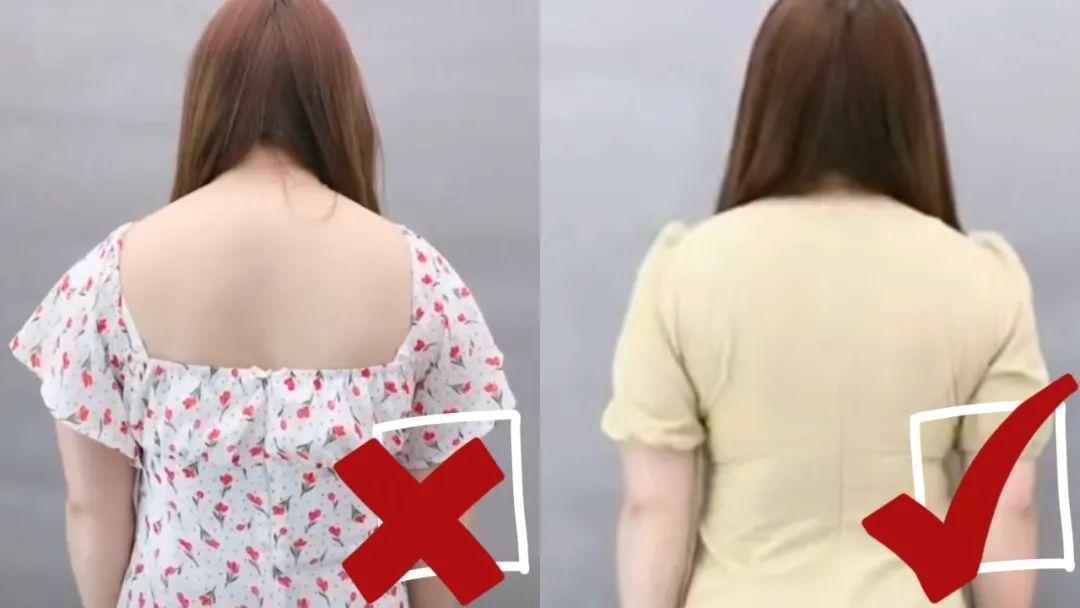 富贵包真的很丑吗,有富贵包会影响寿命吗