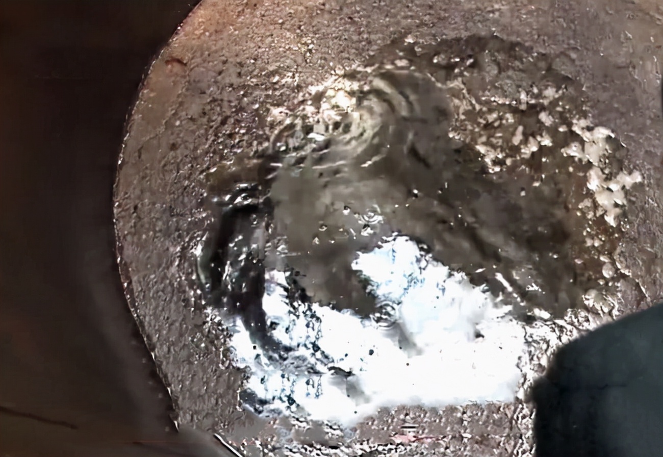 河南男子掉锅烫伤爸妈植皮救儿子,河南男子掉入油锅后续