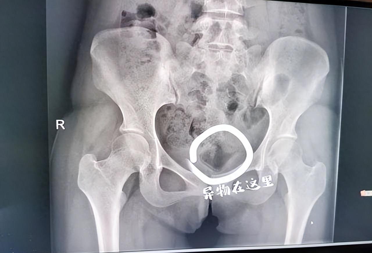 19岁女大学生为寻求刺激，跟男朋友干了一件疯狂的事儿！