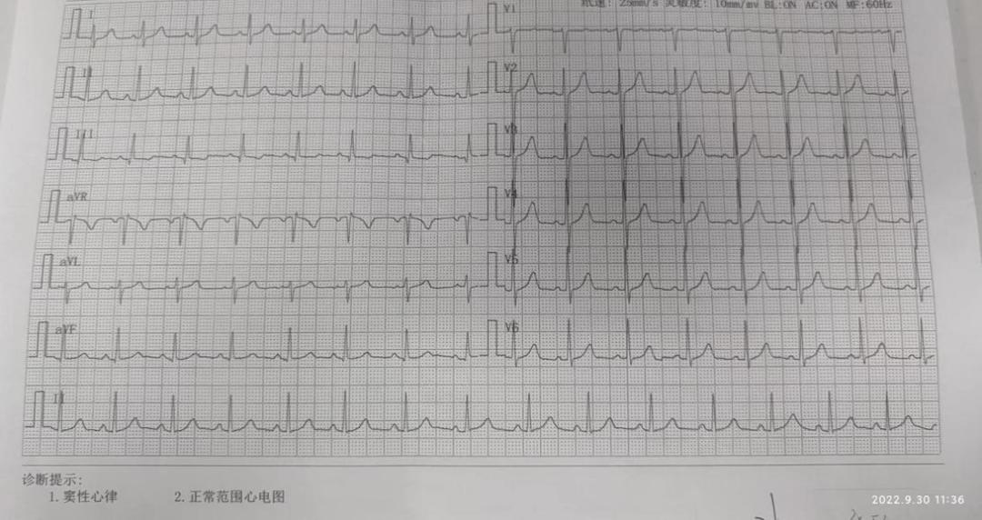 盐酸戊乙奎醚注射液给药途径,盐酸戊乙奎醚注射液的功效