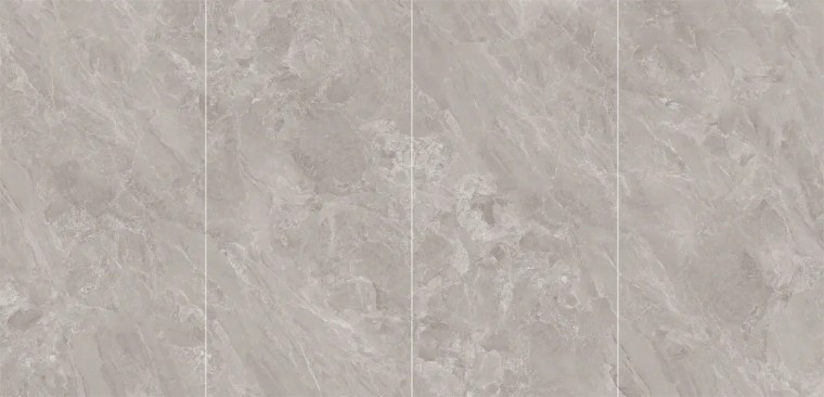 395平米轻奢法式风格别墅装修设计,威尔斯法式风别墅整装设计效果图