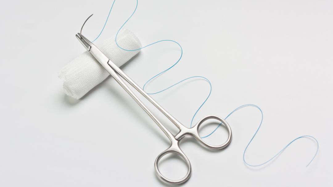 外伤缝针有什么治愈不留疤的办法,缝针会留下蜈蚣疤吗