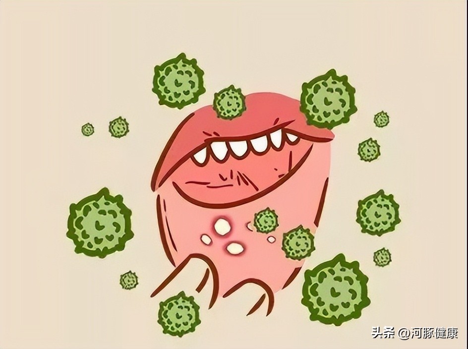 长期口腔溃疡不疼不痒,长期口腔溃疡不愈合会怎样