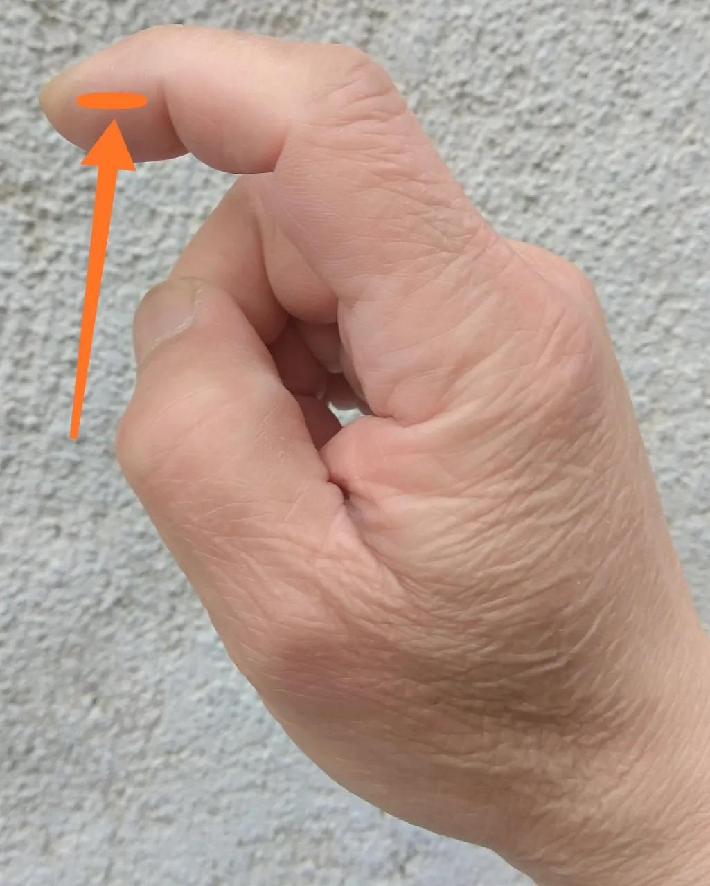 眼眶胀痛、上眼皮浮肿、双眼模糊，教你一招缓解