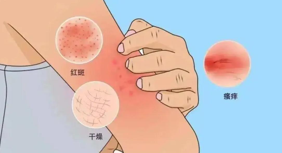 你以为的皮肤病却成了艾滋病，若出现这4种症状，说明病入膏肓了