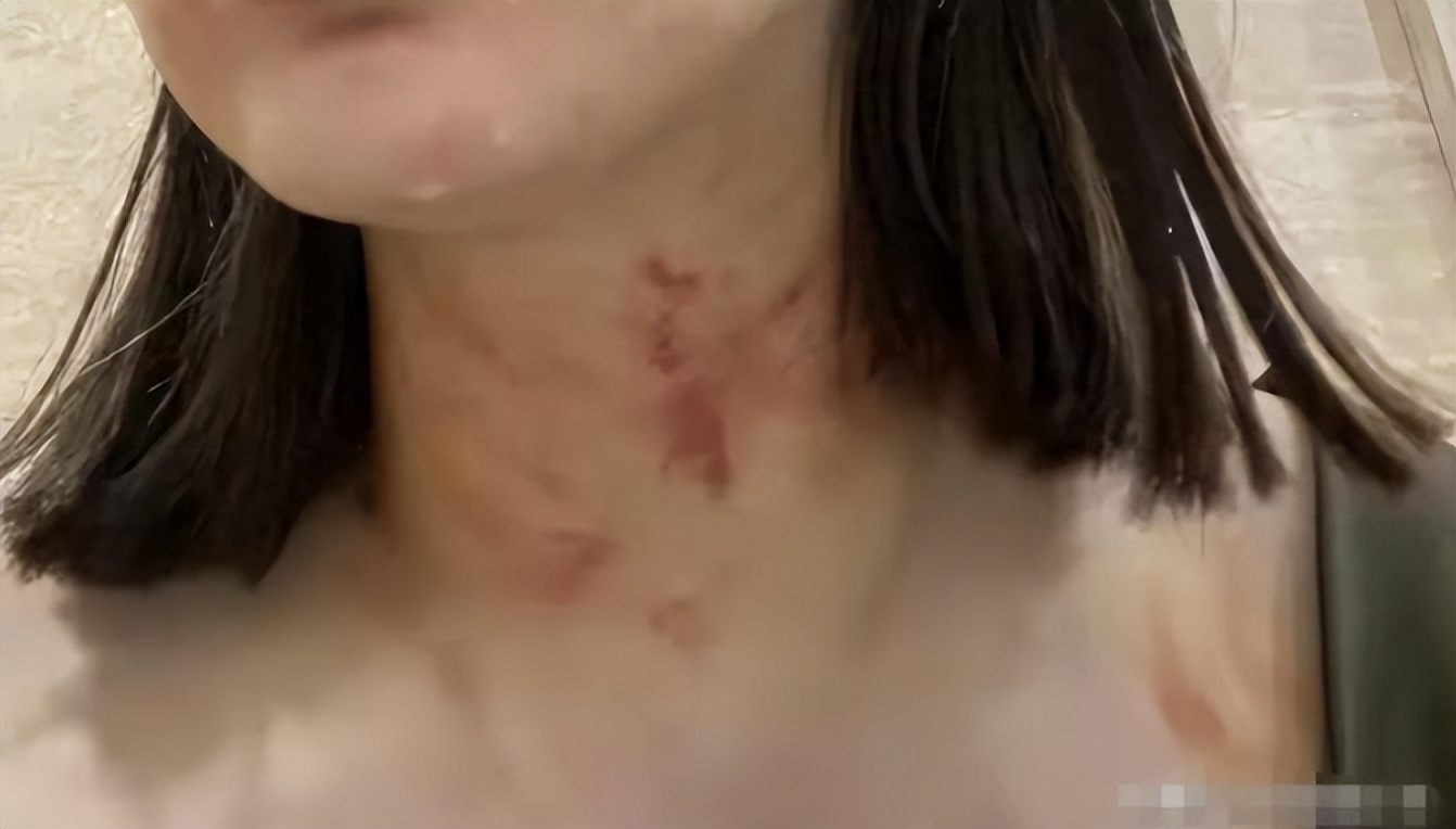 女子电梯内被大型犬咬死,女子在电梯内被自家狗撕咬