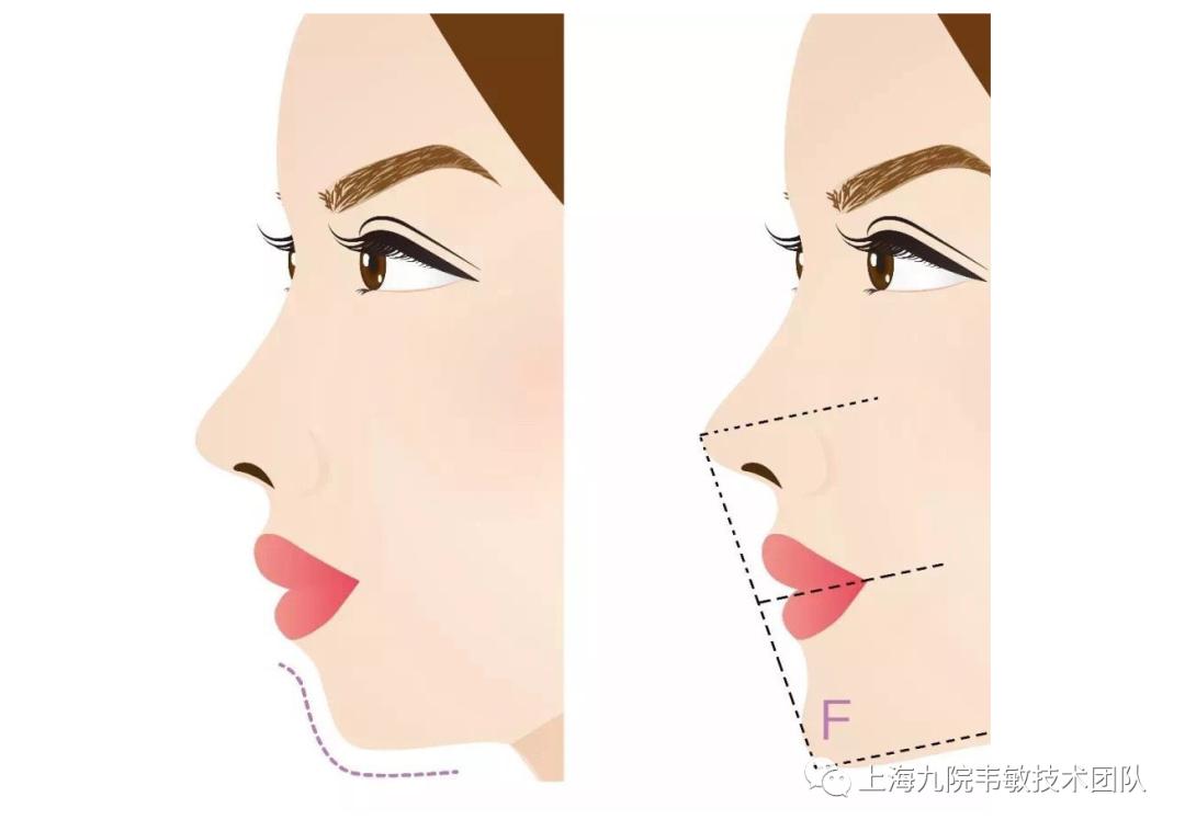 上海九院韦敏看胎记吗,九院韦敏案例