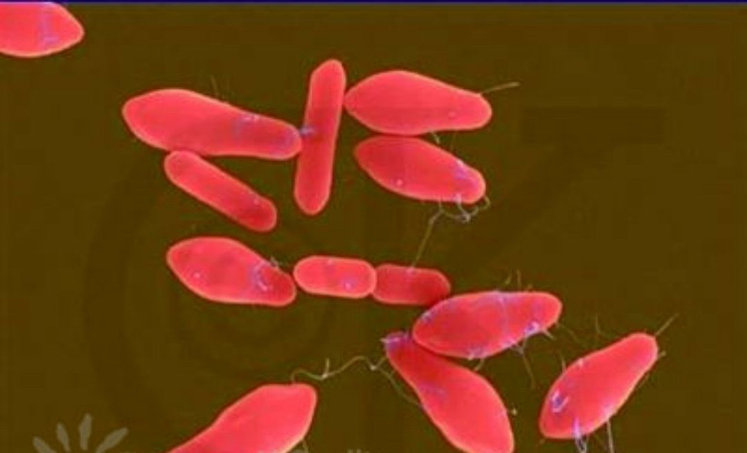 湿润烧伤膏对肛裂应用原理,湿润烧伤膏治疗肛周脓肿