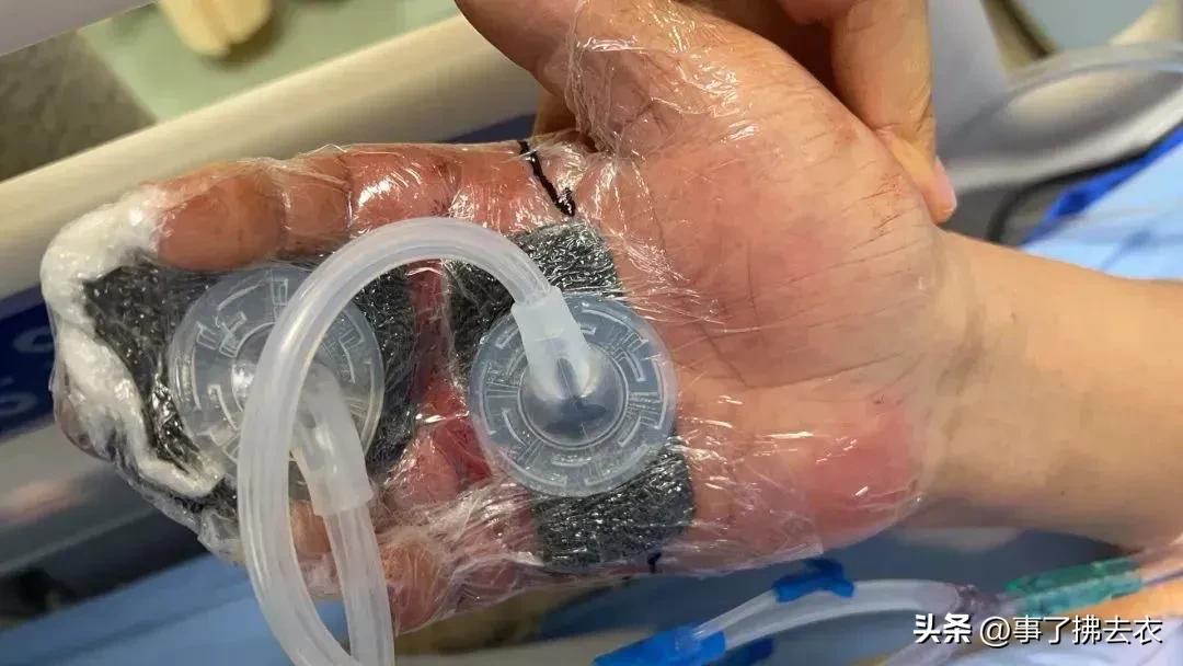 一条鱼引发的惨剧,一条鱼引发的悲剧8死13伤