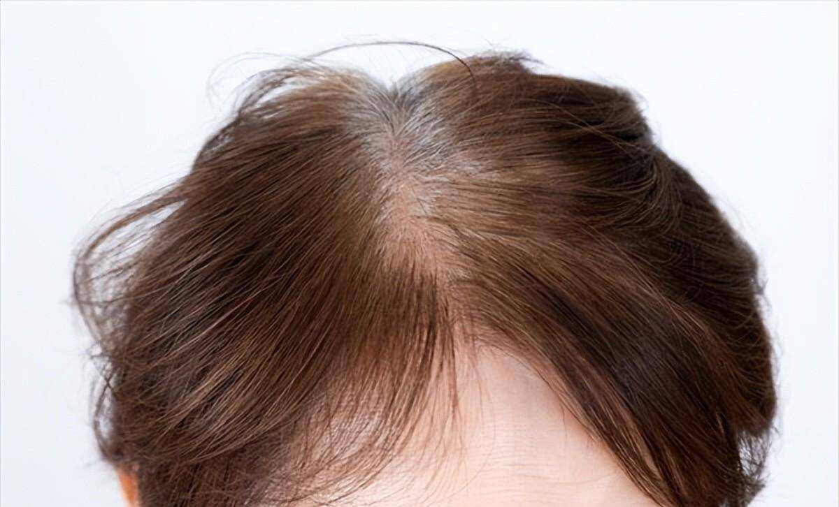 年纪大了为什么头发稀疏了,随着年龄增长头发变稀疏正常吗