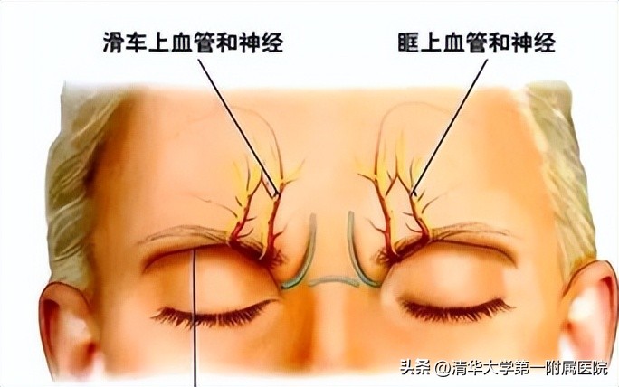 额头磕伤了伤口发白怎么办,额头碰伤出现血印怎么处理