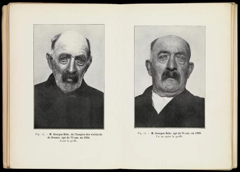 痴迷不老和壮阳，西方科学家曾将动物*丸睾**移植进人体