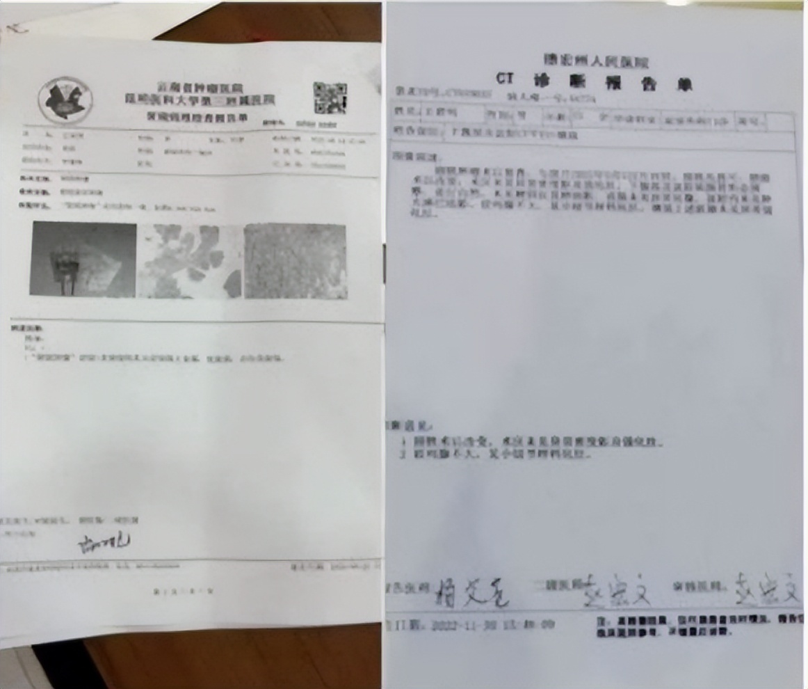 陈海林治疗癌症,陈海林肿瘤名医