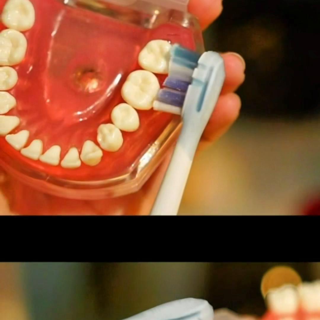 滂臭预警！牙缝抠出来的软垢到底是什么？#usmile笑容加