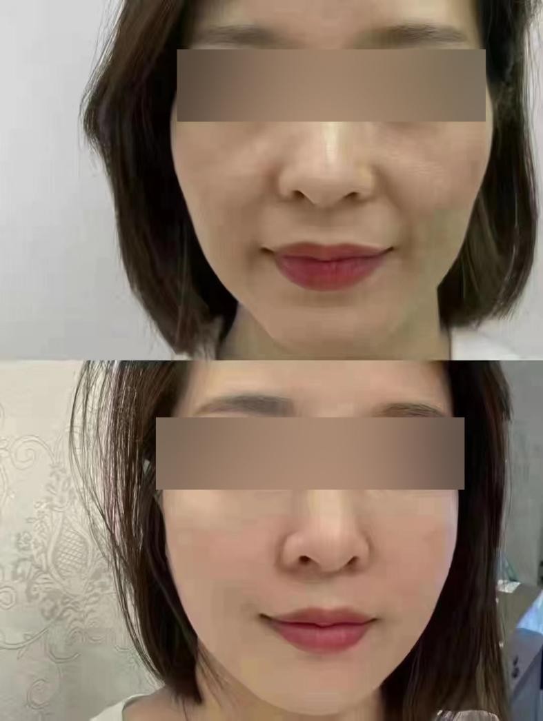 抗衰攻略项目大全,抗衰小细节详细介绍