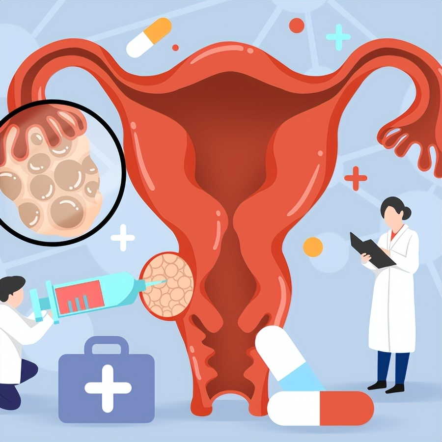 纵隔子宫是否都需要治疗？