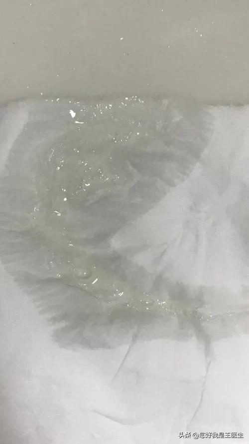 脾胃虚寒咳嗽有白痰吃哪些中成药,胸闷气短咳嗽有白痰吃什么中成药