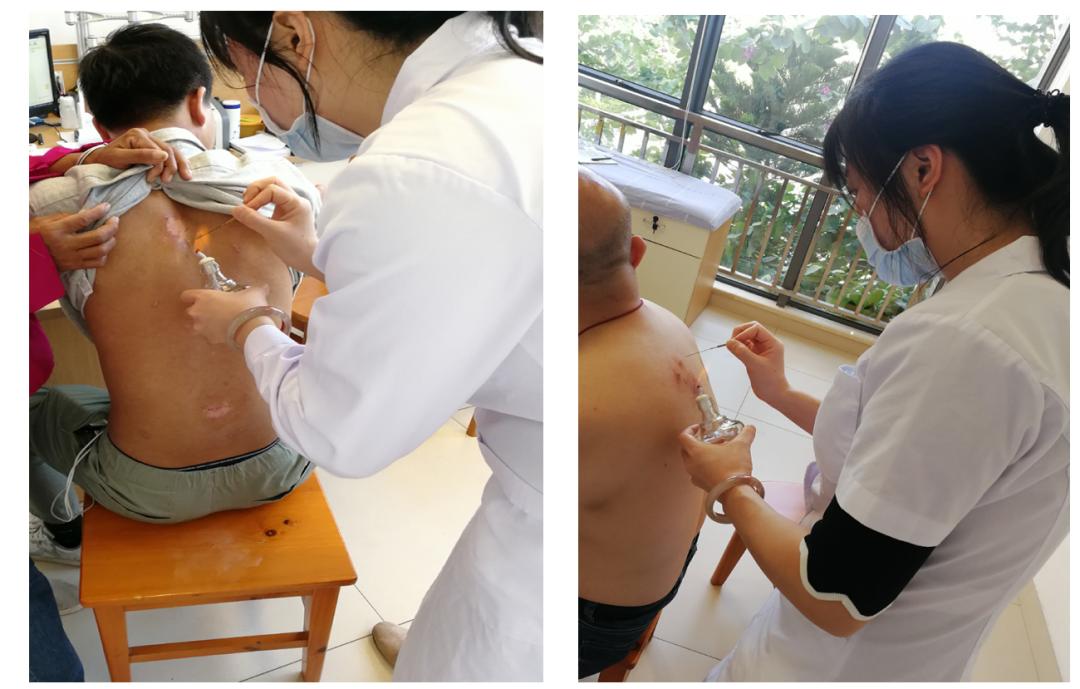 天热湿疹痒痒痒？中医治疗退！退！退！