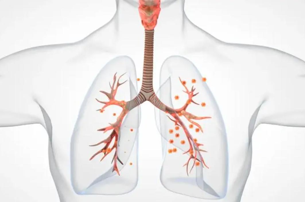 太原醋厂冰乙酸勾兑食醋整改措施,醋厂用冰乙酸勾兑食醋