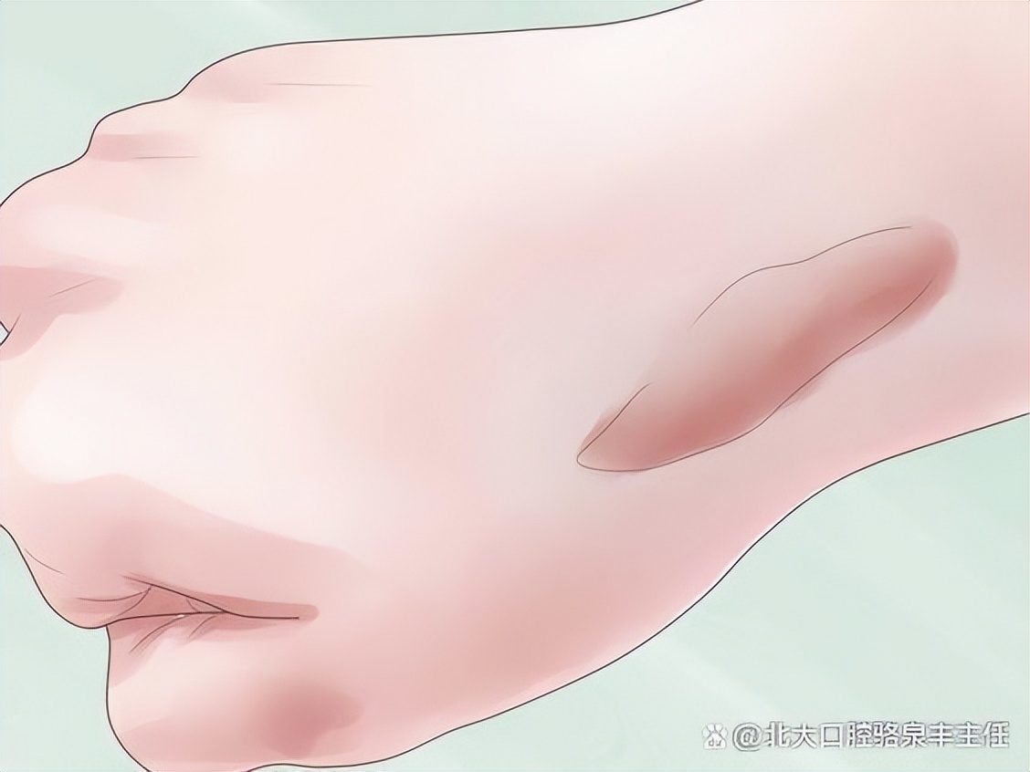 祛疤贴怎么用效果最好,祛疤凝胶好还是疤痕贴好