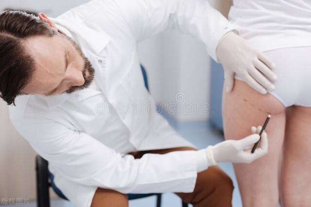 科普痔疮不治疗后果,肛门坠胀健康科普