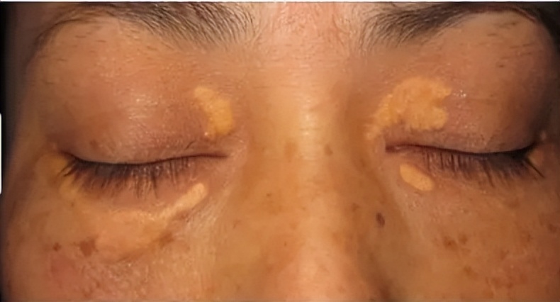 身体出现6个症状暗示猝死降临,身体出现这6种信号警惕猝死