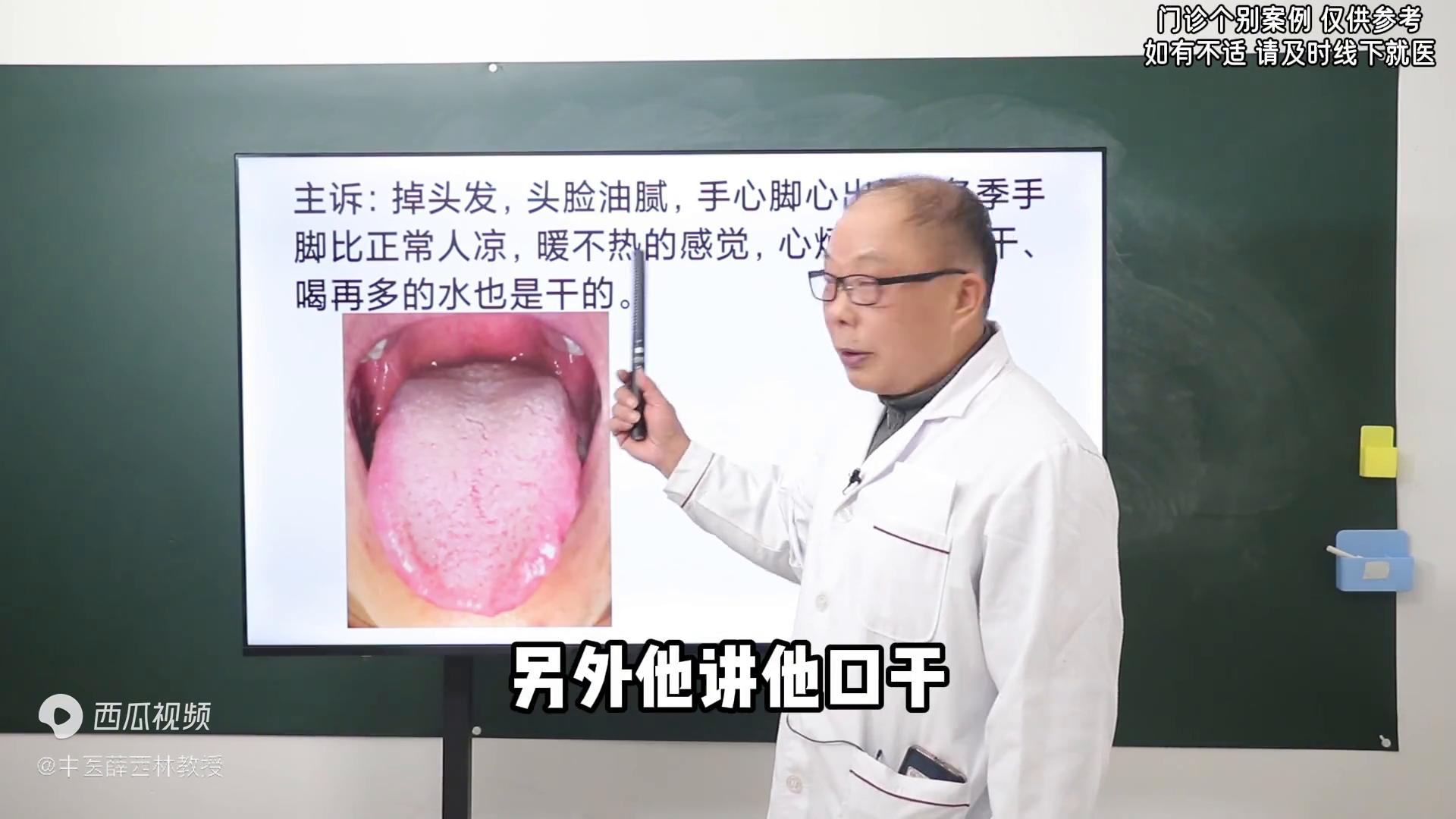 头脸出油严重吃什么,头脸身体出油