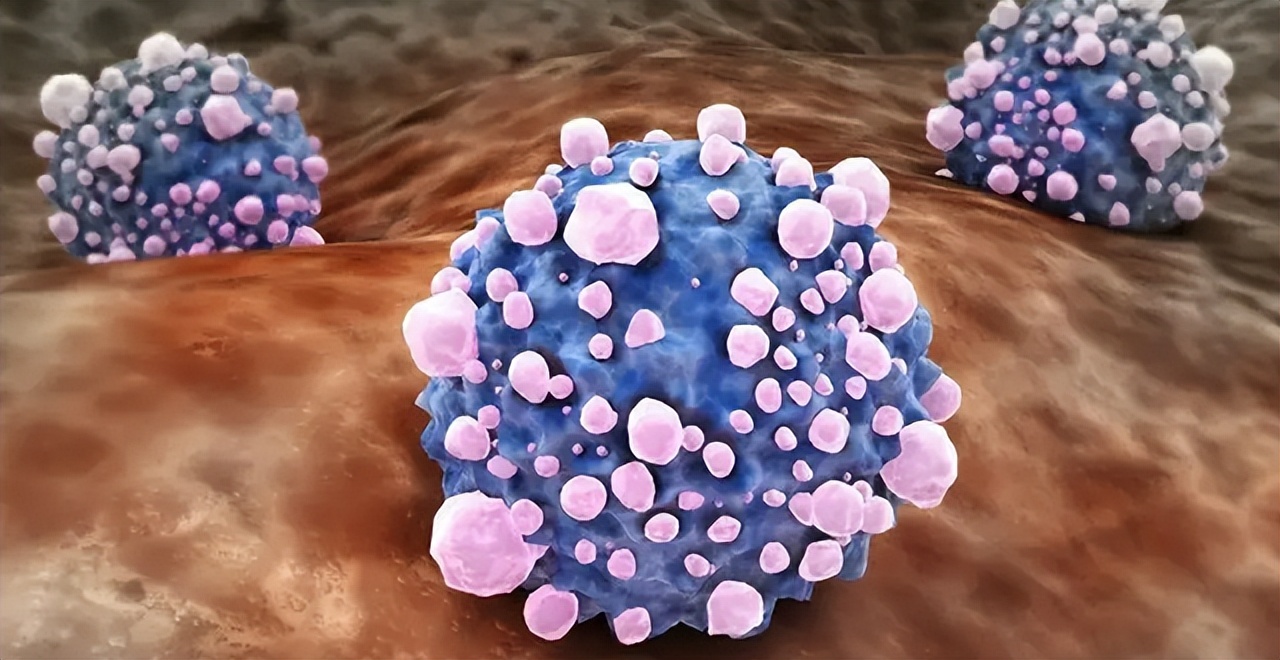 肿瘤界争议,肿瘤病不可怕疾病都是可防可治的