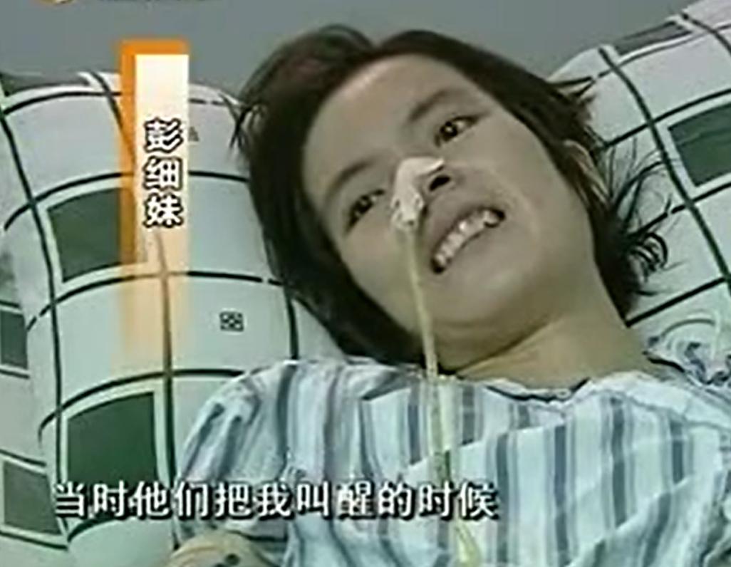 广东女子怀胎12个月肚子重达50斤,广东女子挺50公斤肚子