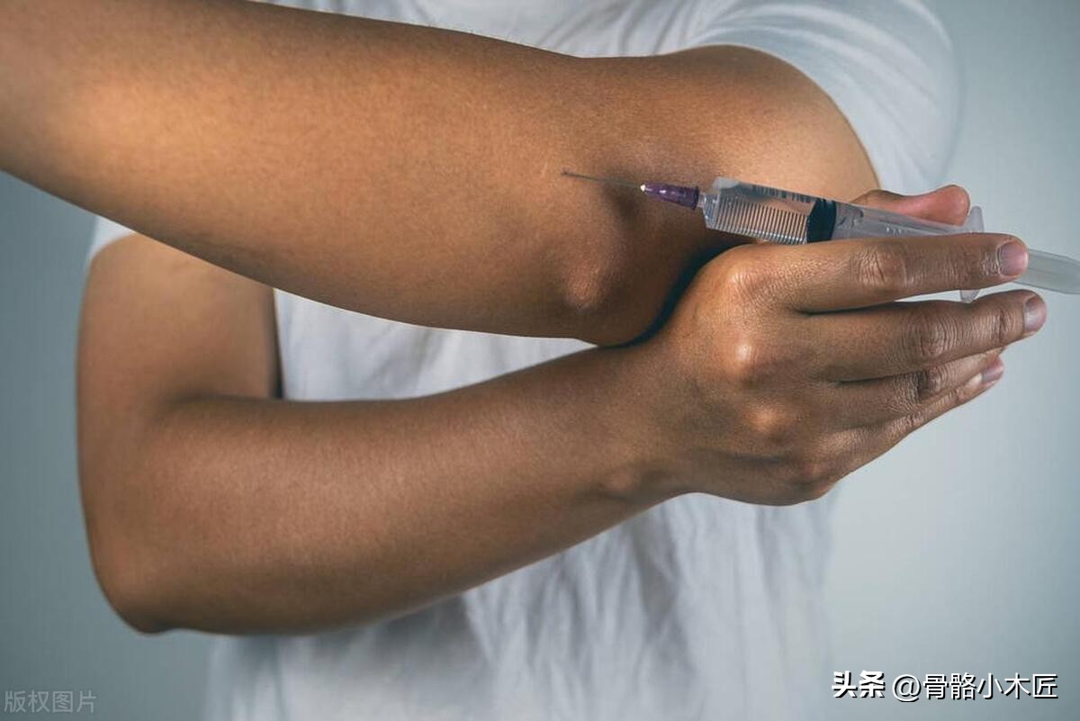 外伤肱骨外上髁炎,运动损伤的骨膜炎怎么治