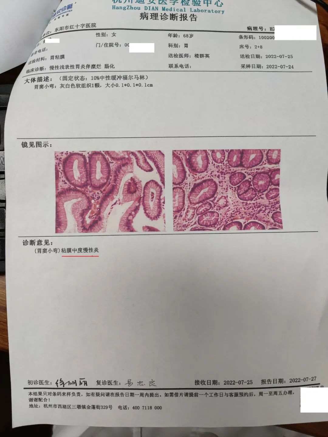 肠化调理中医,中医治疗中度肠化逆转案例