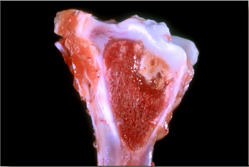 鸡有哪些疾病,鸡有炎症什么表现